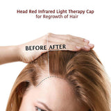 Hair Growth Booster Kit - Red light Therapy Cap